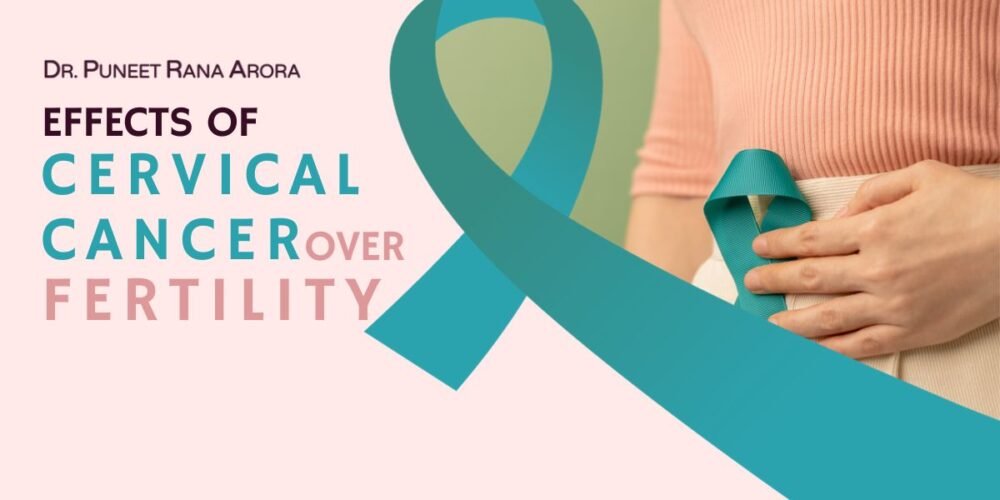 Effects of Cervical Cancer over Fertility 1 Effects of Cervical Cancer over Fertility